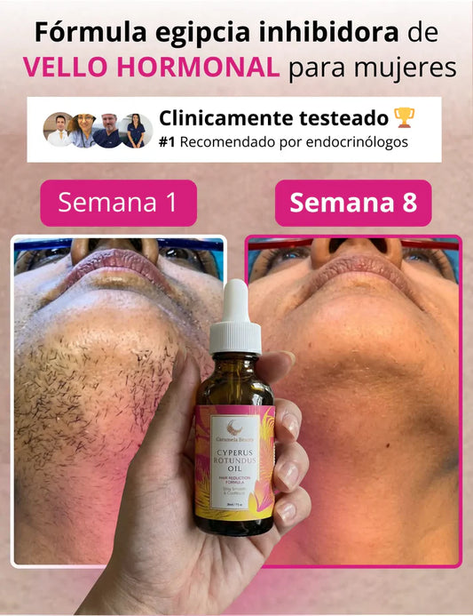 Cyperus Rotundus: Reduce El Crecimiento Del Vello y Revela Una Piel Suave y Perfecta Desde Casa 🧴